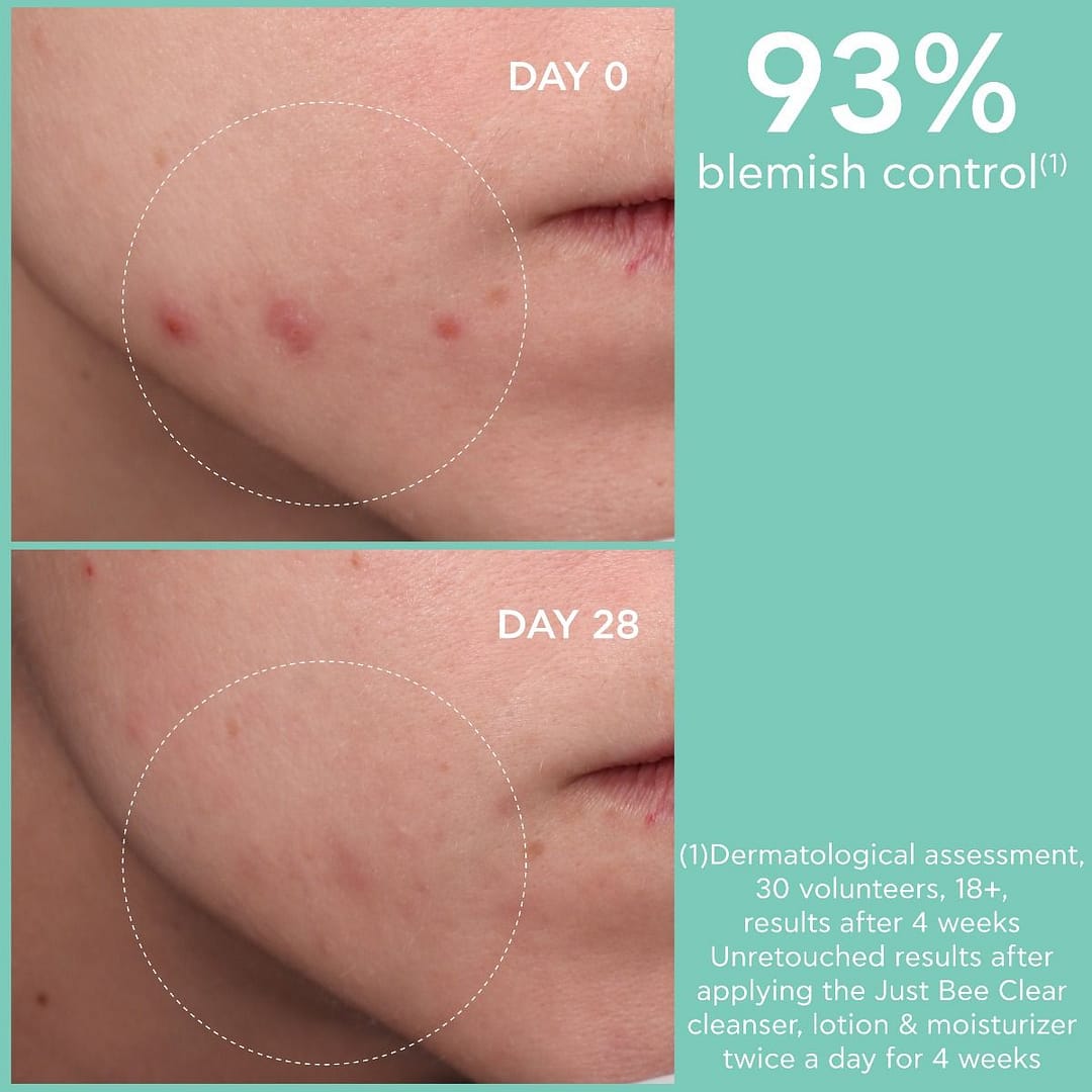 <p style="text-align: center;"><strong>JUST BEE CLEAR</strong></p><p>Κρέμα Κατά Των Ατελειών - Ενυδάτωση Ματ Αποτέλεσμα</p> - Image 4